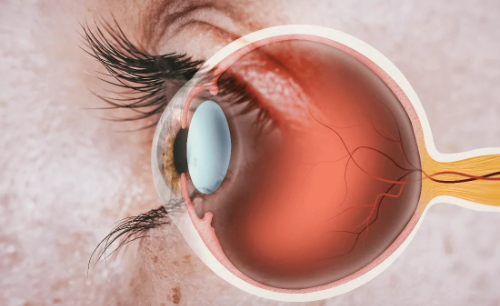 retinawebp